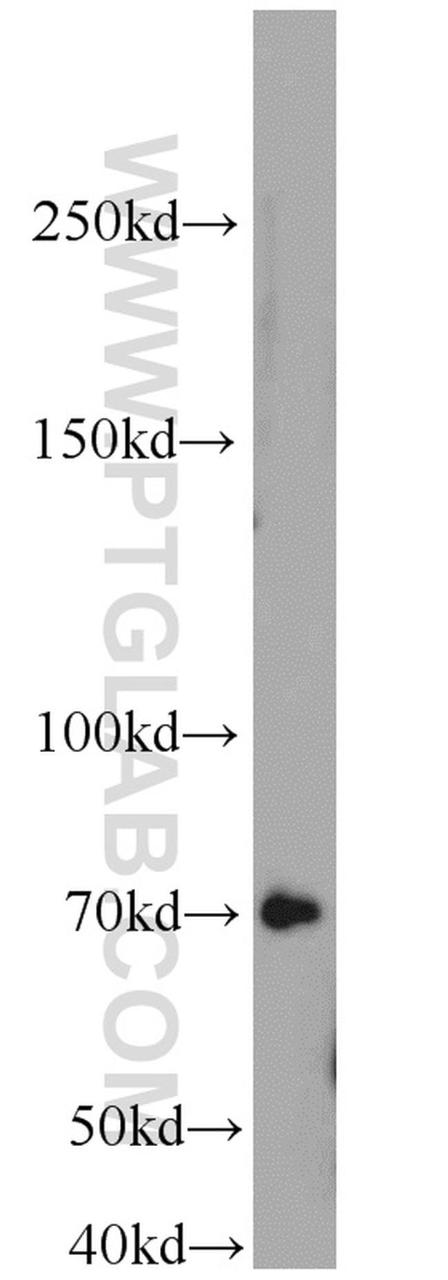 E2F4 Antibody in Western Blot (WB)