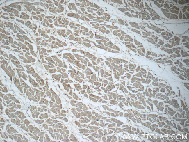 Renin receptor/ATP6AP2 Antibody in Immunohistochemistry (Paraffin) (IHC (P))