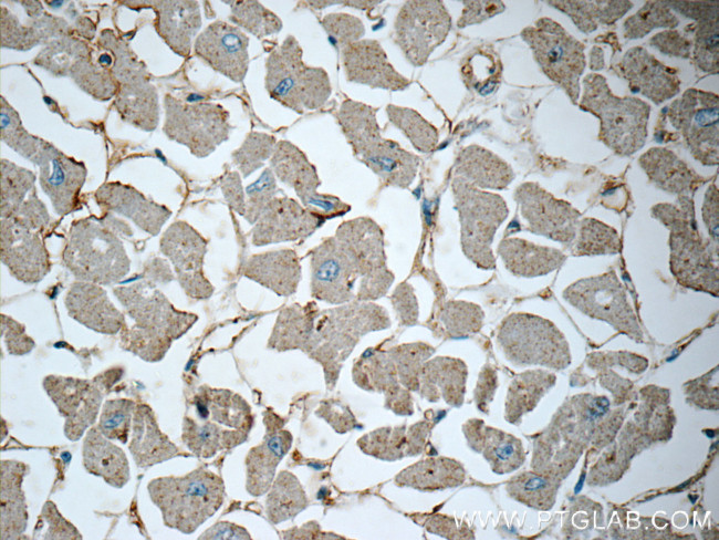 Renin receptor/ATP6AP2 Antibody in Immunohistochemistry (Paraffin) (IHC (P))