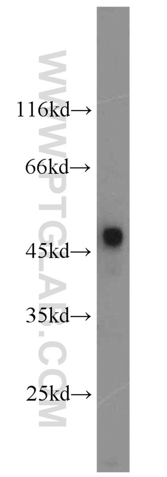 Renin receptor/ATP6AP2 Antibody in Western Blot (WB)