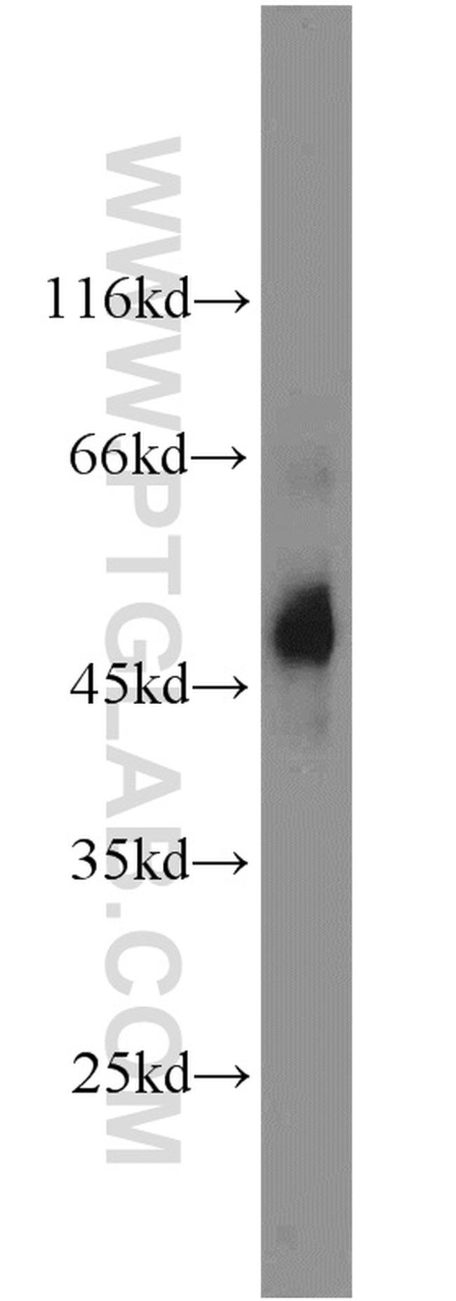 Renin receptor/ATP6AP2 Antibody in Western Blot (WB)