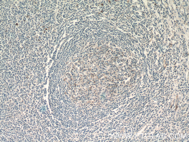 CXCL13/BCA1 Antibody in Immunohistochemistry (Paraffin) (IHC (P))