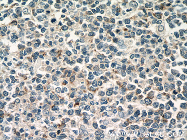 CXCL13/BCA1 Antibody in Immunohistochemistry (Paraffin) (IHC (P))