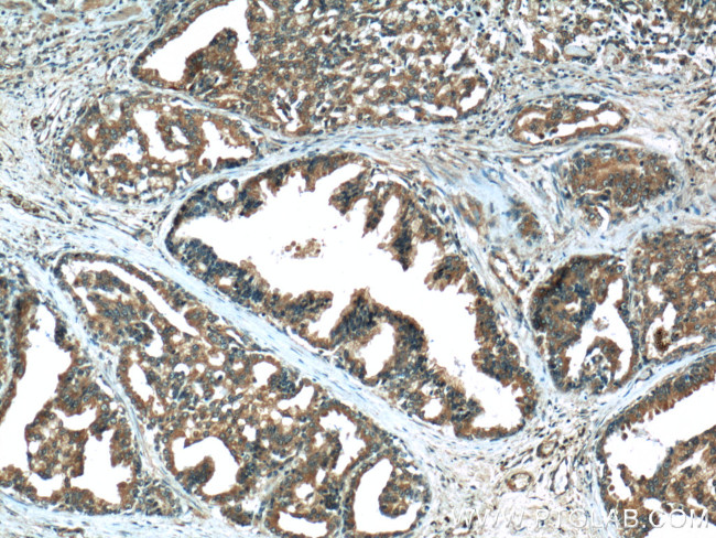 AMPK alpha 1 Antibody in Immunohistochemistry (Paraffin) (IHC (P))