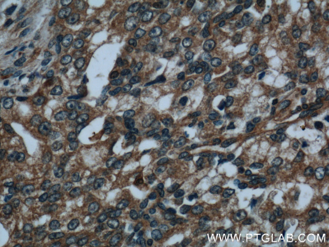 AMPK alpha 1 Antibody in Immunohistochemistry (Paraffin) (IHC (P))