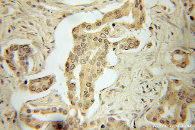 AMPK alpha 1 Antibody in Immunohistochemistry (Paraffin) (IHC (P))