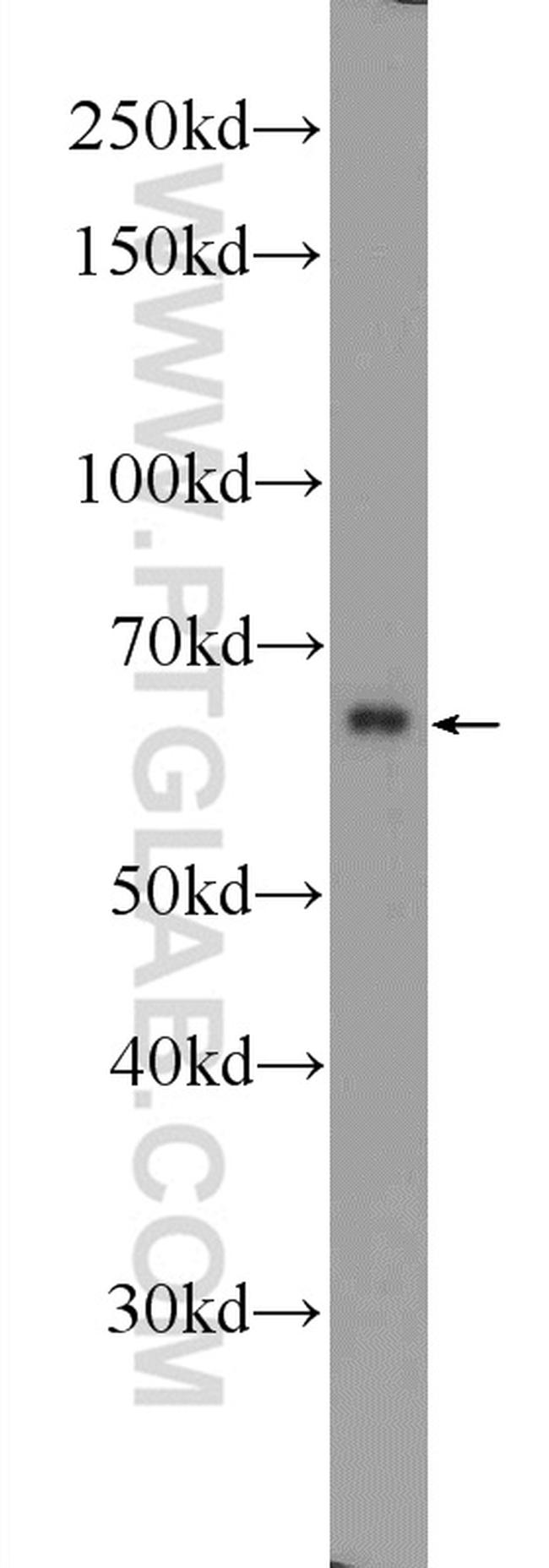 AMPK alpha 1 Antibody in Western Blot (WB)