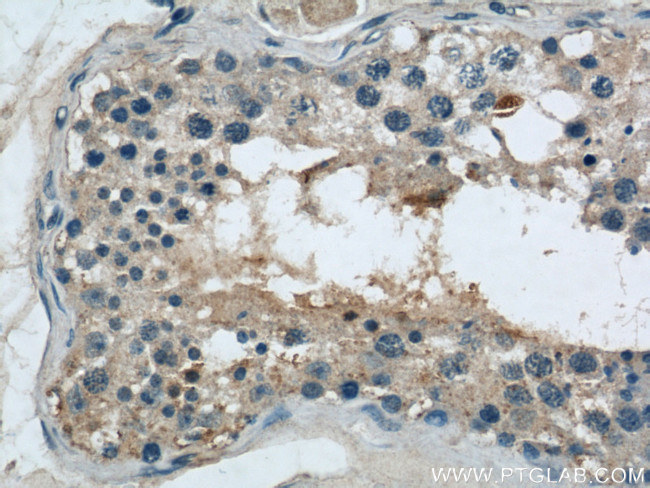 ARPC4 Antibody in Immunohistochemistry (Paraffin) (IHC (P))