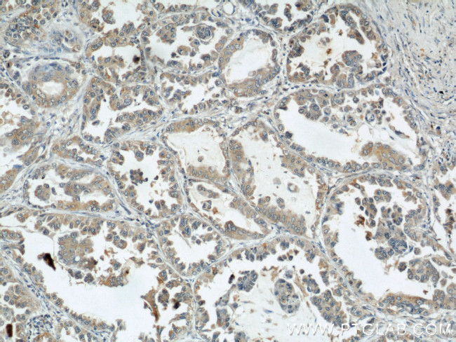 ARPC4 Antibody in Immunohistochemistry (Paraffin) (IHC (P))