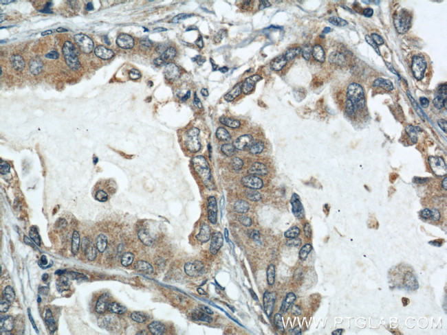 ARPC4 Antibody in Immunohistochemistry (Paraffin) (IHC (P))