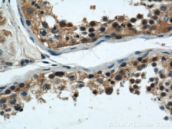 ARPC4 Antibody in Immunohistochemistry (Paraffin) (IHC (P))