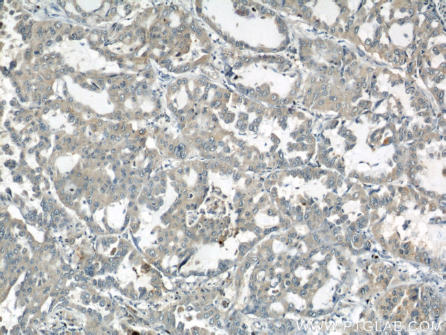 ARPC4 Antibody in Immunohistochemistry (Paraffin) (IHC (P))