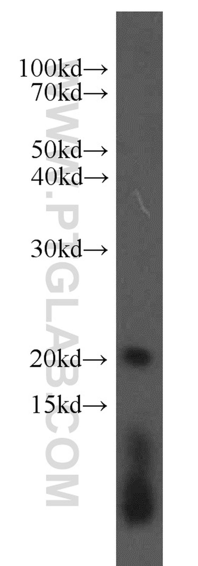 ARPC4 Antibody in Western Blot (WB)