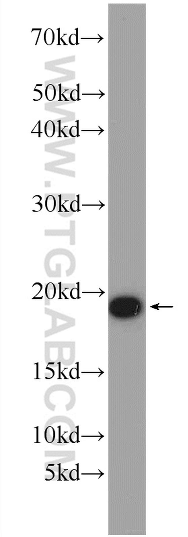 ARPC4 Antibody in Western Blot (WB)