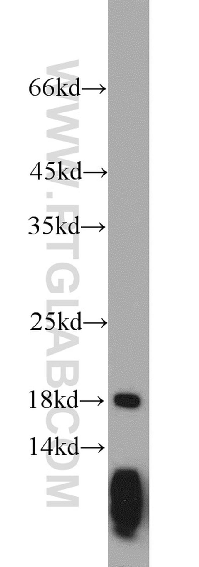 ARPC4 Antibody in Western Blot (WB)