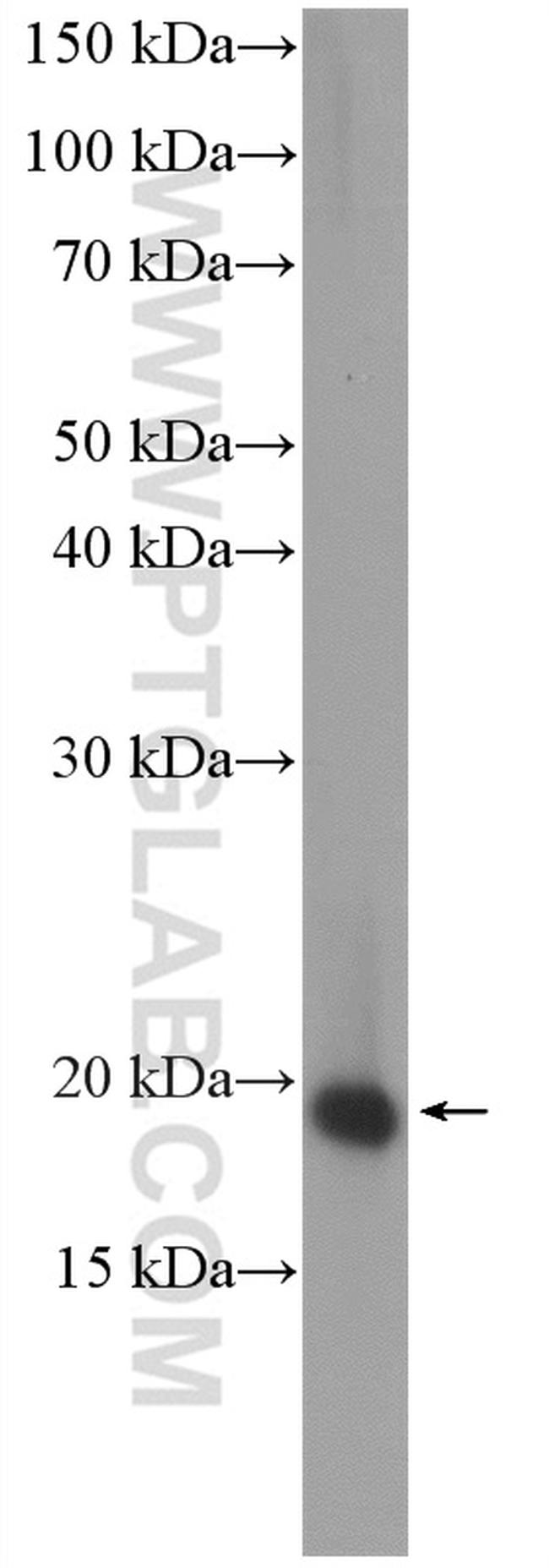 ARPC4 Antibody in Western Blot (WB)