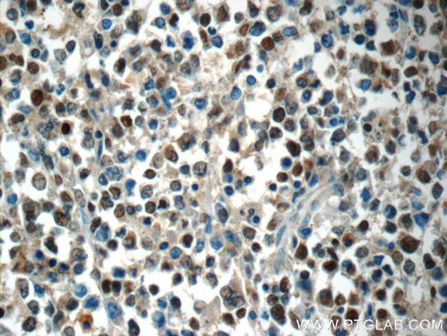 MEF2BNB Antibody in Immunohistochemistry (Paraffin) (IHC (P))