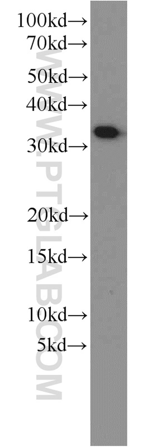 MEF2BNB Antibody in Western Blot (WB)