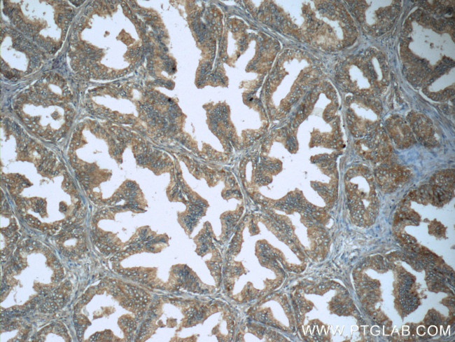 Lactoferrin Antibody in Immunohistochemistry (Paraffin) (IHC (P))