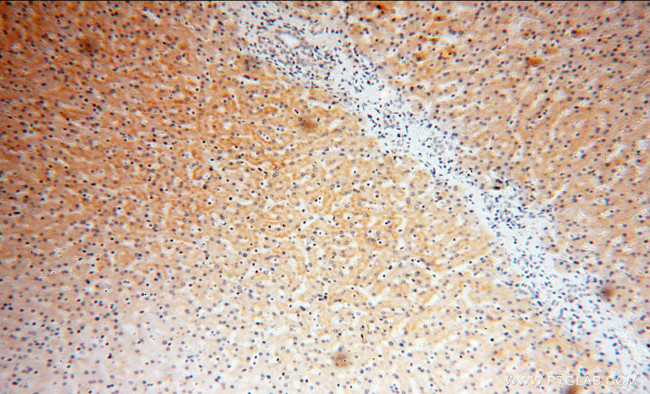 Lactoferrin Antibody in Immunohistochemistry (Paraffin) (IHC (P))