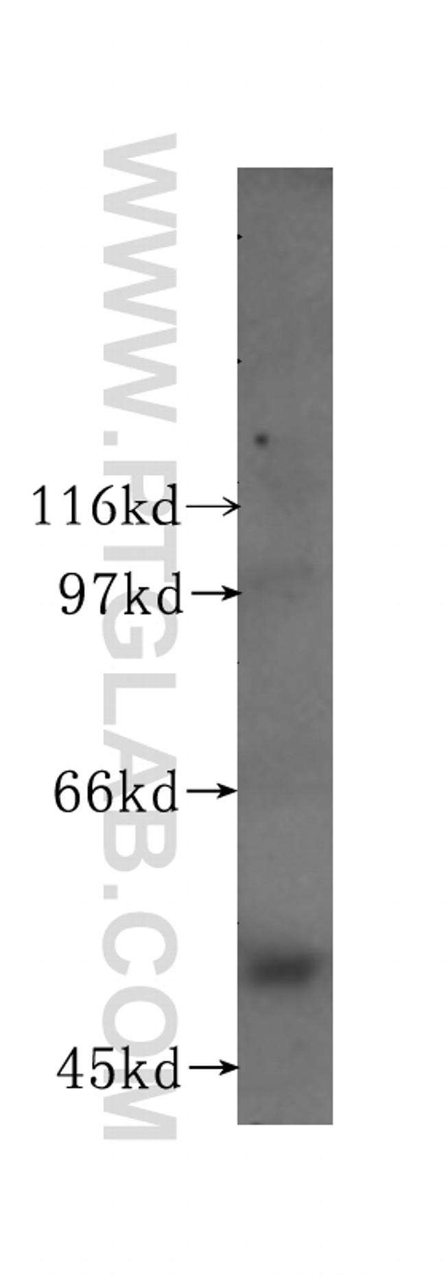 Lactoferrin Antibody in Western Blot (WB)