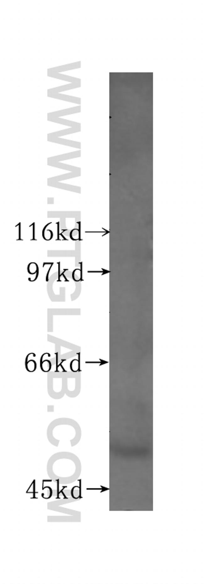 Lactoferrin Antibody in Western Blot (WB)