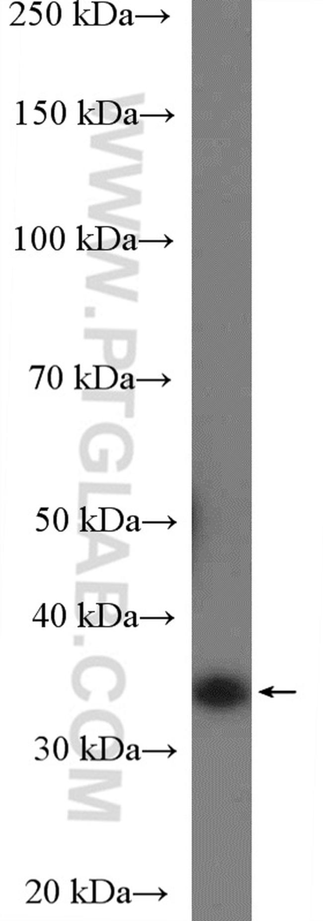 Cyclin D2 Antibody in Western Blot (WB)