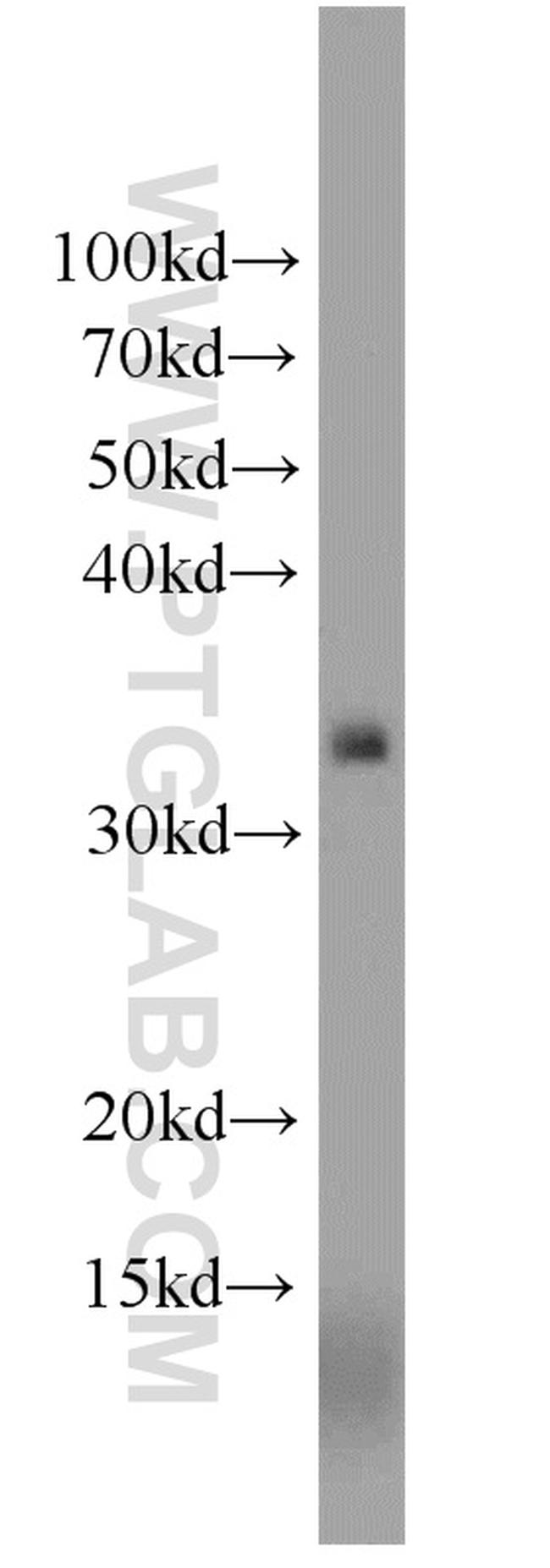 NKG2A Antibody in Western Blot (WB)