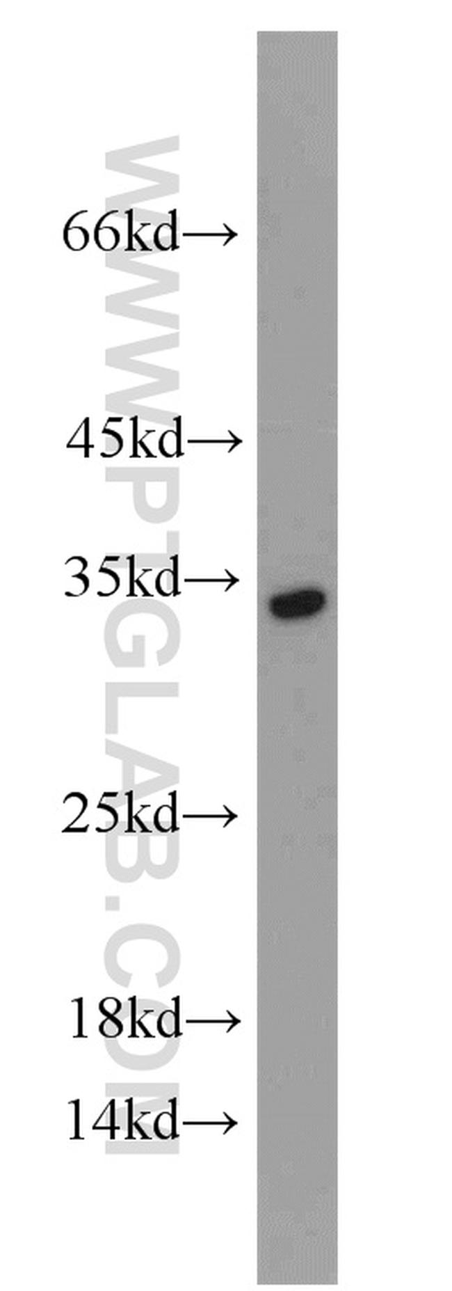 NKG2A Antibody in Western Blot (WB)