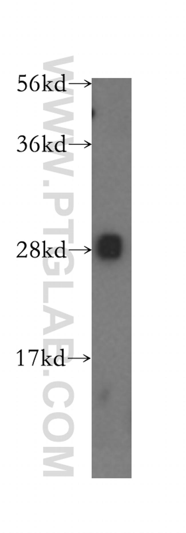 NKG2A Antibody in Western Blot (WB)