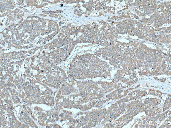 YWHAB Antibody in Immunohistochemistry (Paraffin) (IHC (P))