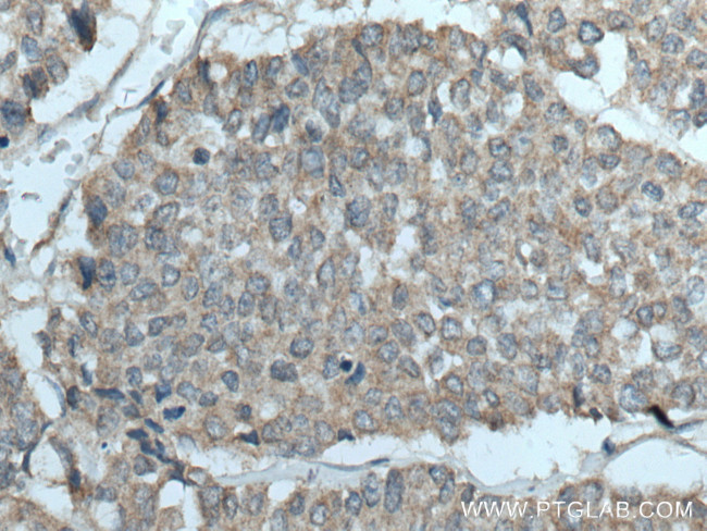 YWHAB Antibody in Immunohistochemistry (Paraffin) (IHC (P))