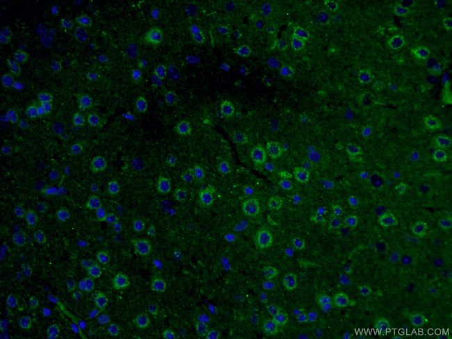 CRH/CRF Antibody in Immunohistochemistry (Paraffin) (IHC (P))