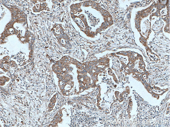 CRH/CRF Antibody in Immunohistochemistry (Paraffin) (IHC (P))