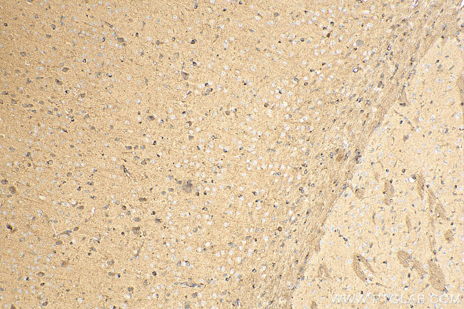 RTN4/NOGO Antibody in Immunohistochemistry (Paraffin) (IHC (P))