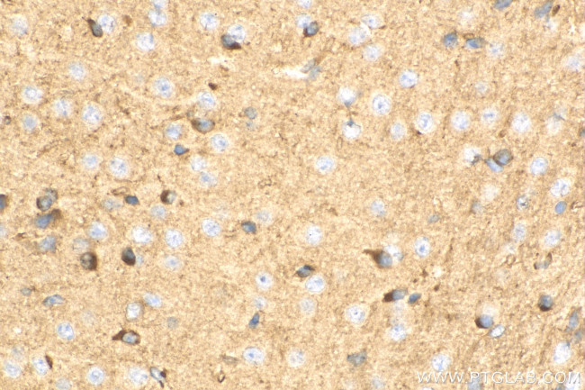 RTN4/NOGO Antibody in Immunohistochemistry (Paraffin) (IHC (P))