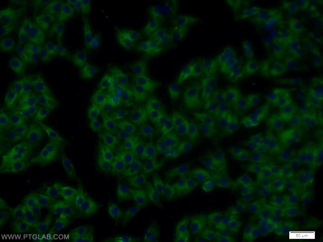 RTN4/NOGO Antibody in Immunocytochemistry (ICC/IF)