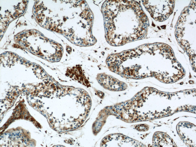 RTN4/NOGO Antibody in Immunohistochemistry (Paraffin) (IHC (P))