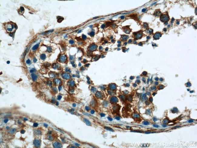 RTN4/NOGO Antibody in Immunohistochemistry (Paraffin) (IHC (P))