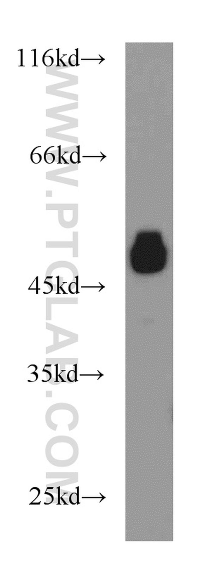 RTN4/NOGO Antibody in Western Blot (WB)