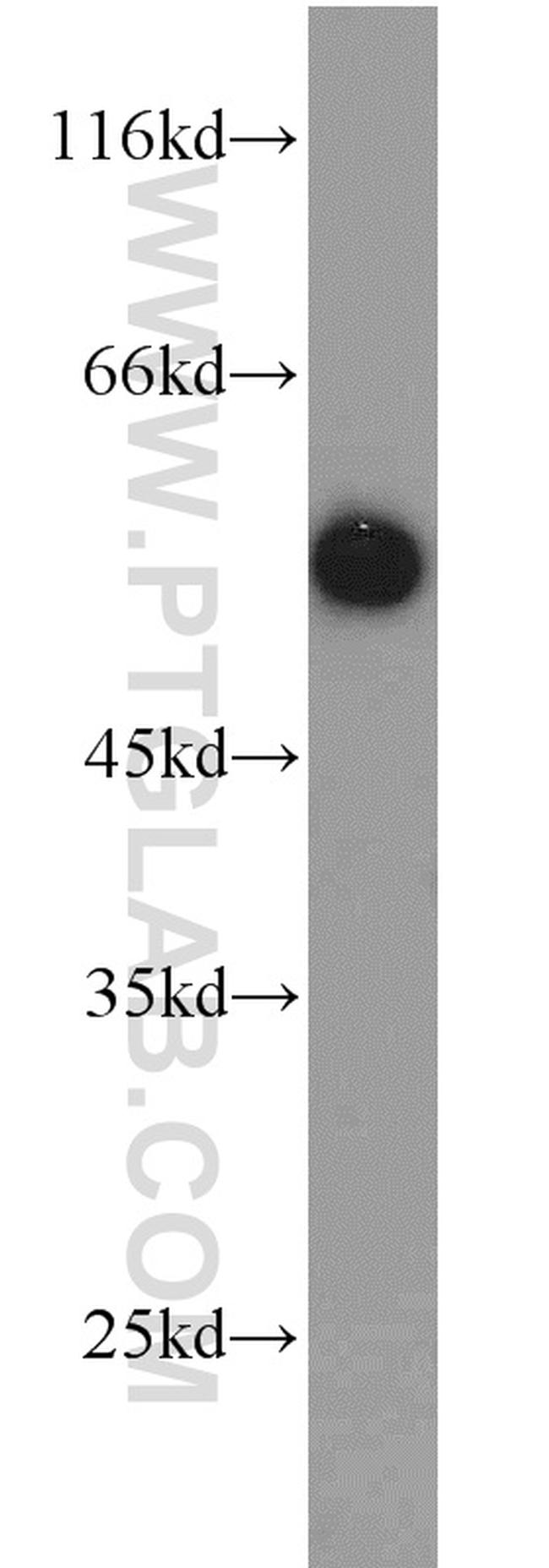 RTN4/NOGO Antibody in Western Blot (WB)