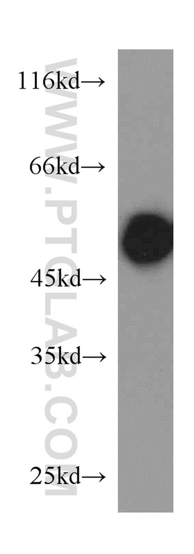 RTN4/NOGO Antibody in Western Blot (WB)