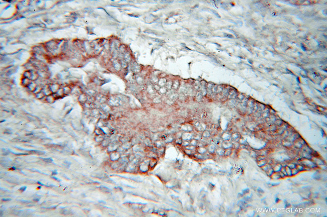 PDHX Antibody in Immunohistochemistry (Paraffin) (IHC (P))