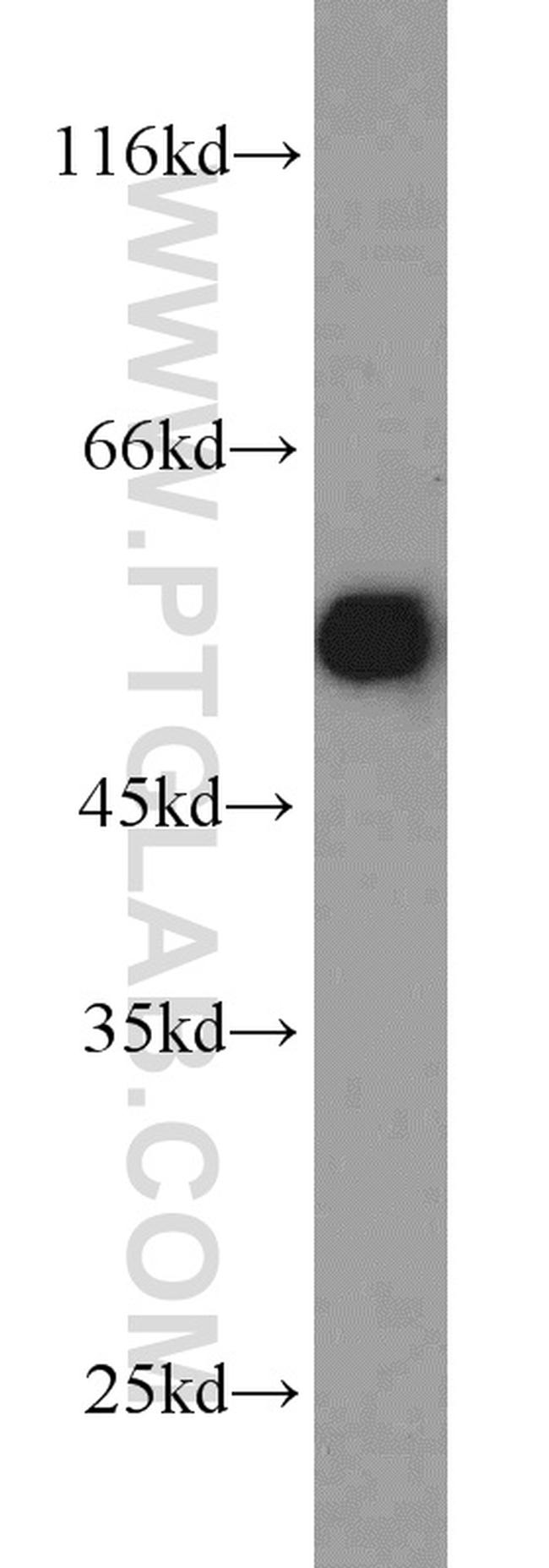 PDHX Antibody in Western Blot (WB)