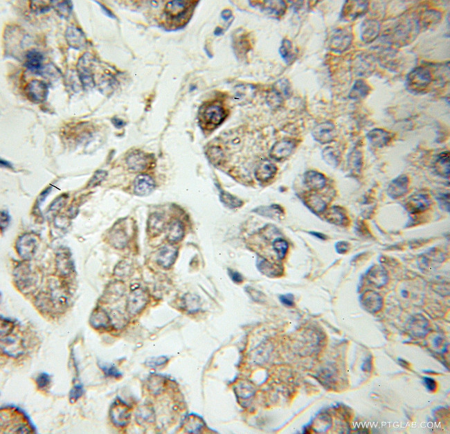 Secretogranin III Antibody in Immunohistochemistry (Paraffin) (IHC (P))