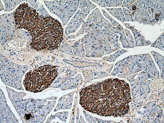 Secretogranin III Antibody in Immunohistochemistry (Paraffin) (IHC (P))