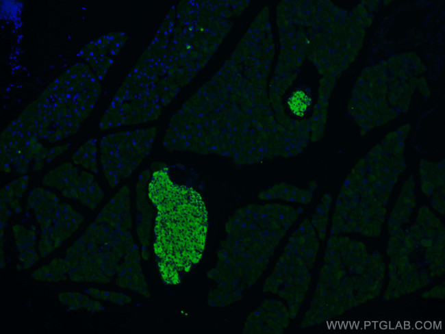 Secretogranin III Antibody in Immunohistochemistry (PFA fixed) (IHC (PFA))