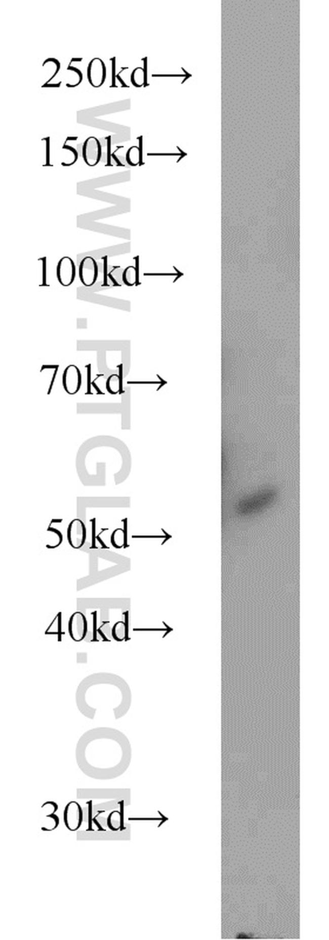 Secretogranin III Antibody in Western Blot (WB)