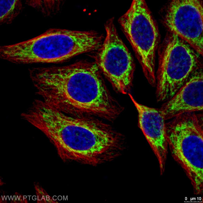 FIS1 Antibody in Immunocytochemistry (ICC/IF)