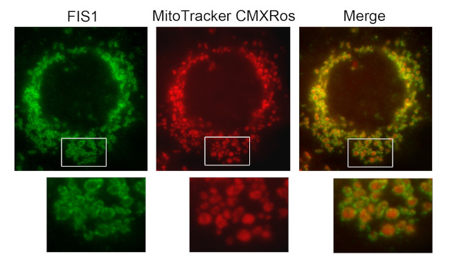 FIS1 Antibody in Immunocytochemistry (ICC/IF)